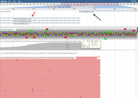 Anaplastic Large Cell Lymphoma ALK+ NGS