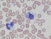 Histoplasmosis in Neutrophils 1