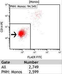 Paroxysmal Nocturnal Hemoglobinuria-Flow Plots