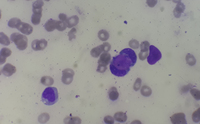 Presence of LE cells in Bone Marrow