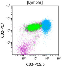 Chronic Lymphoproliferative Disorder of NK Cells - Flow Plots