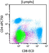 Chronic Lymphoproliferative Disorder of NK Cells - Flow Plots