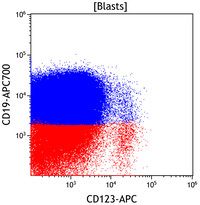 Mixed Phenotype Acute Leukemia, B/myeloid: Flow Plots CD123vsCD19