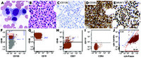 CD138 plasma cell myeloma